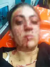 Eski Eşini Çocuklarının Gözü Önünde Bıçakladı: 20 Yıl Hapis İsteği